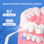 Portable Oral Irrigator – Water Flosser! 💧🦷